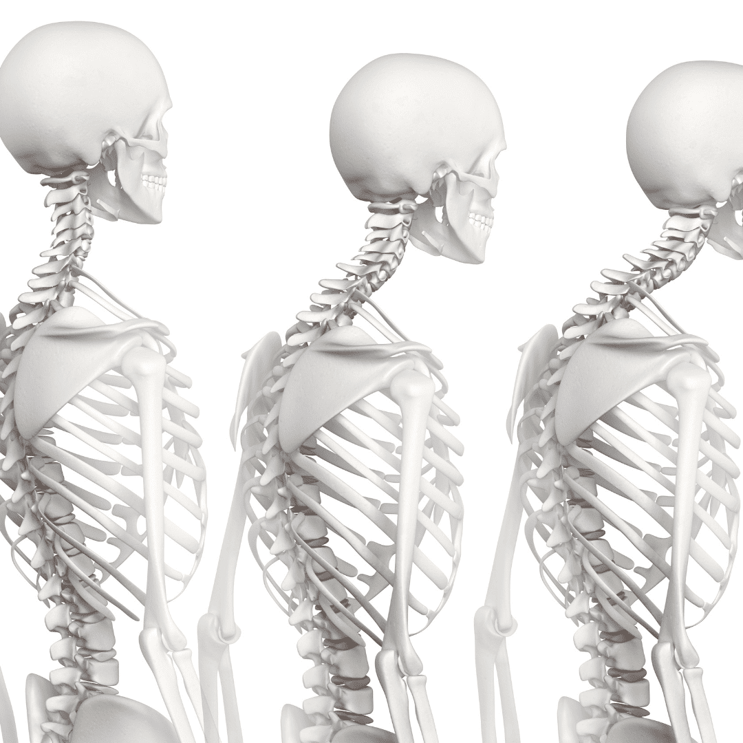 Three human skeletons in profile view, displaying the skull, spine, and ribs.
