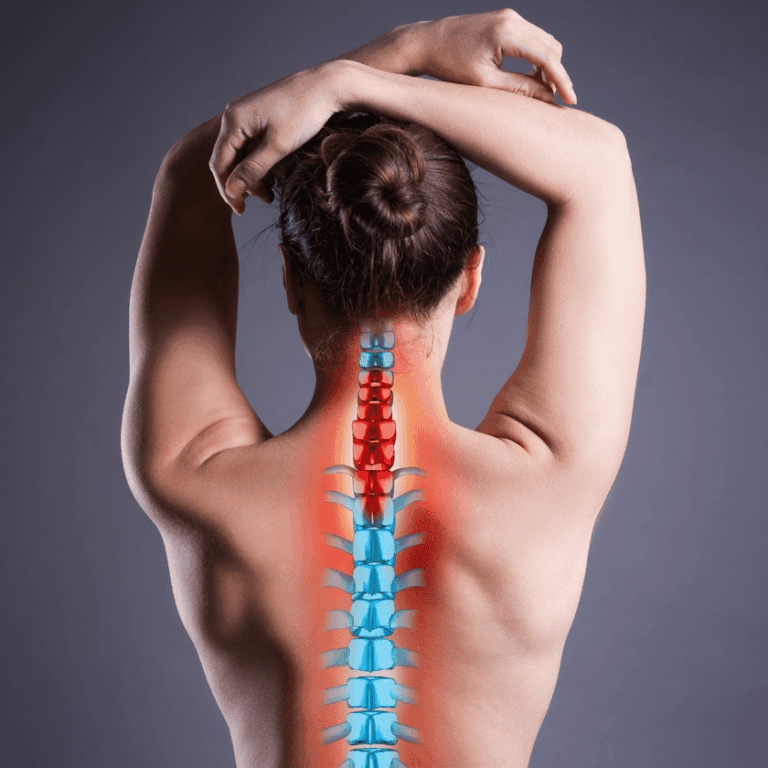 An image of a woman's back with a highlighted spine, displaying red and blue sections to represent areas of tension or pain.