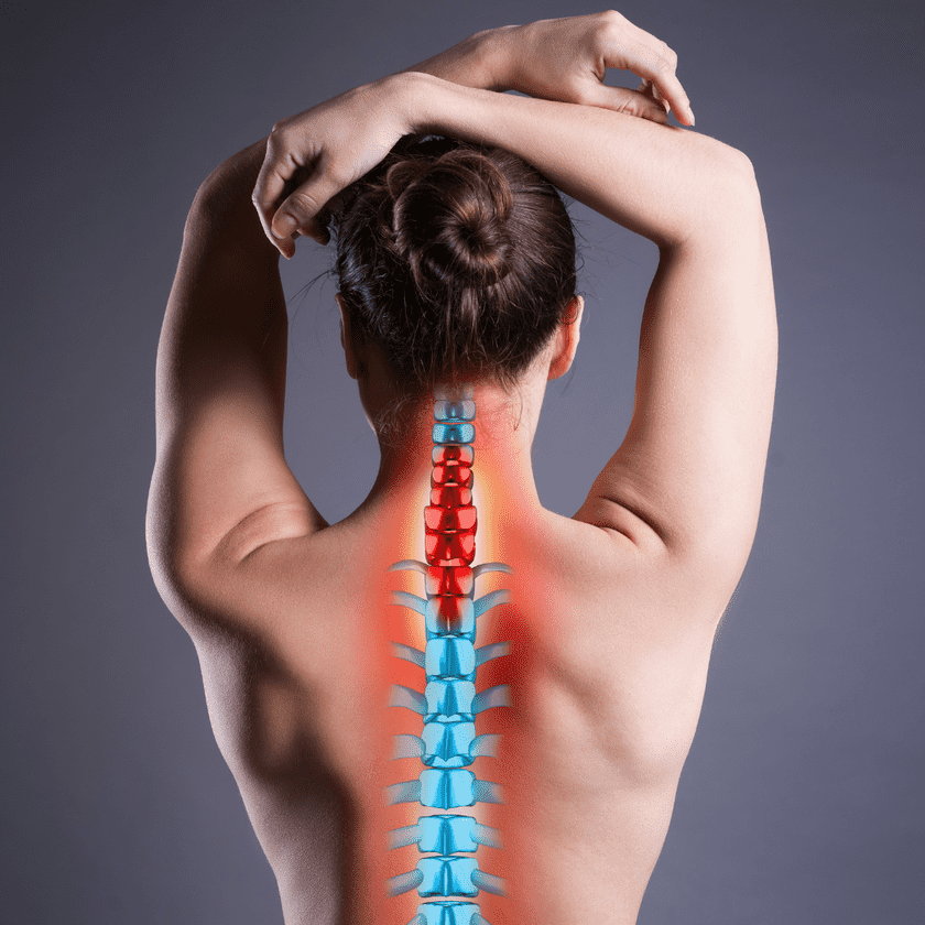An image of a woman's back with a highlighted spine, displaying red and blue sections to represent areas of tension or pain.
